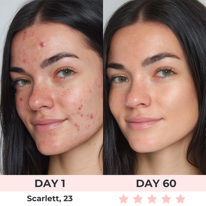 Bellora™ SculptLift Pro – Dispositivo Avanzado de Reafirmación para Rostro y Cuello