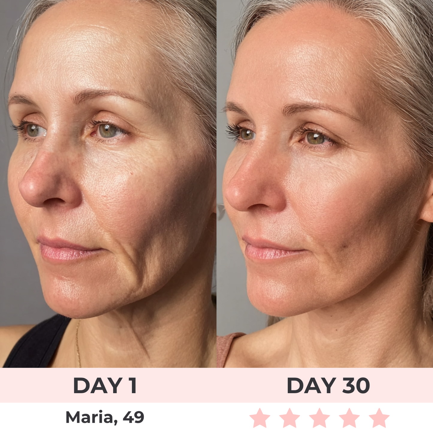 Bellora™ SculptLift Pro – Dispositivo Avanzado de Reafirmación para Rostro y Cuello