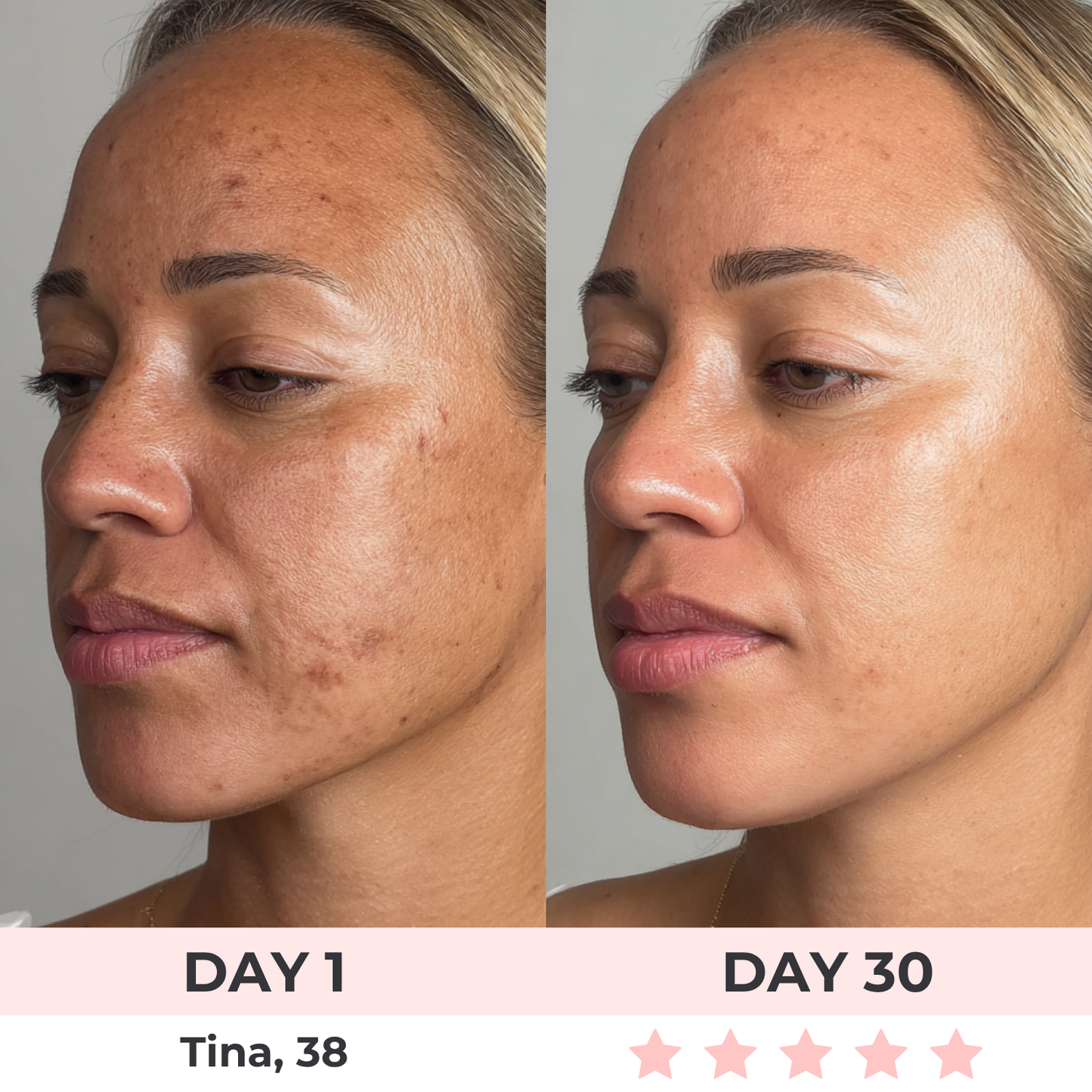 Bellora™ SculptLift Pro – Dispositivo Avanzado de Reafirmación para Rostro y Cuello