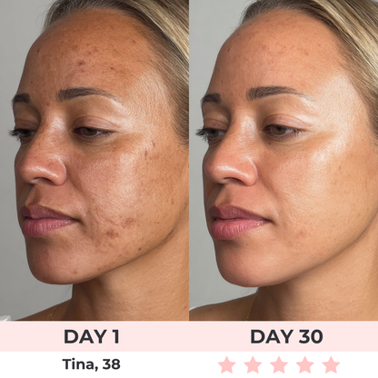 Bellora™ SculptLift Pro – Dispositivo Avanzado de Reafirmación para Rostro y Cuello