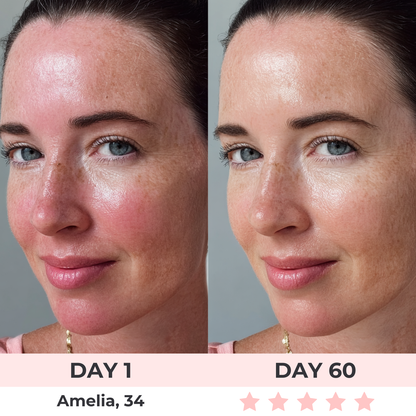 Máscara Facial LED 7 en 1 Bellora™