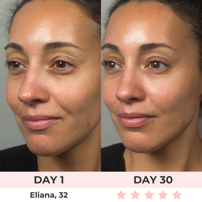 Bellora™ Ojos Sin Arrugas – Gafas LED de Rejuvenecimiento con Luz Roja